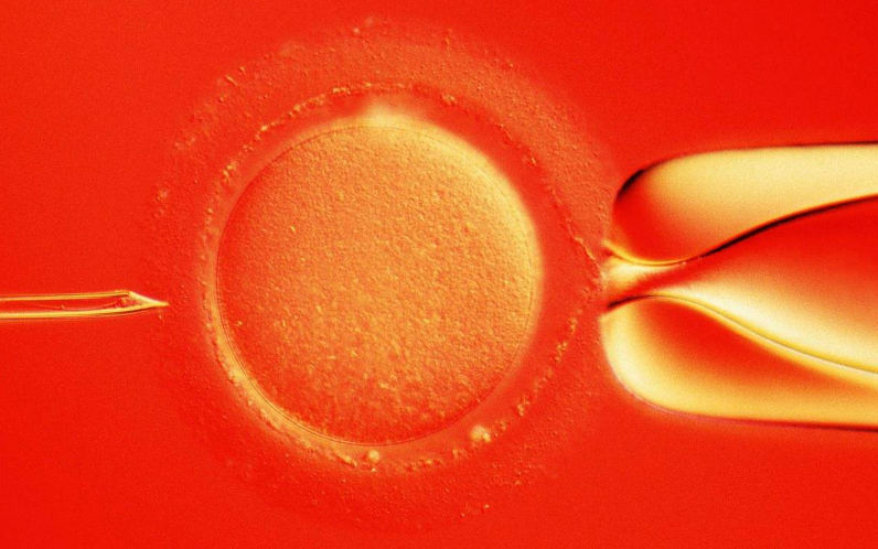 1个月宝宝头围正常值