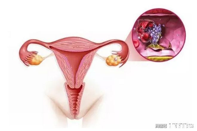 兰州捐卵联系方式