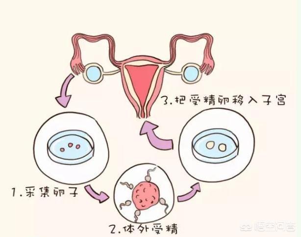 公立医院试管捐卵费用